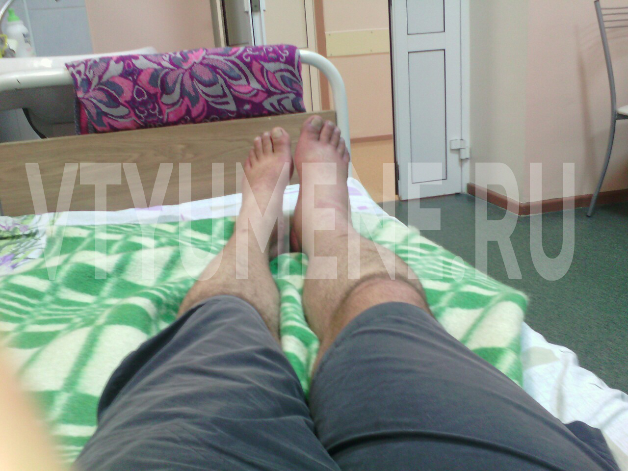 картинки ног в больнице
